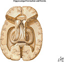 Netter's Atlas of Human Neuroscience