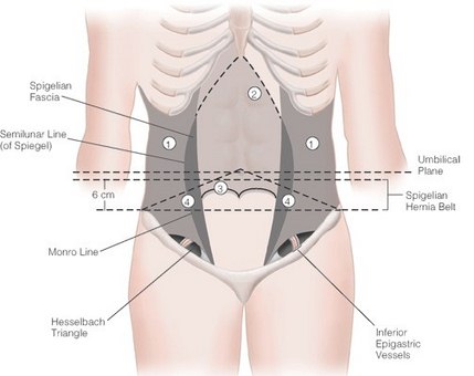 Clinical Cases - Abdominal Hernia