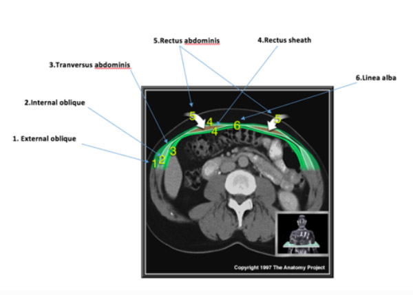 Clinical Cases - Abdominal Hernia