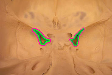 Module - Cranial Nerves