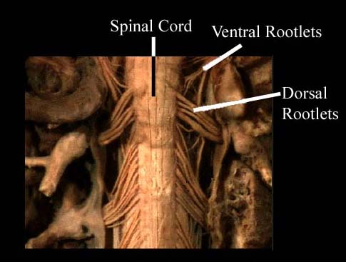Module - Spinal Cord and Spinal Nerve (9 of 14)