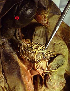 Gross Anatomy Image