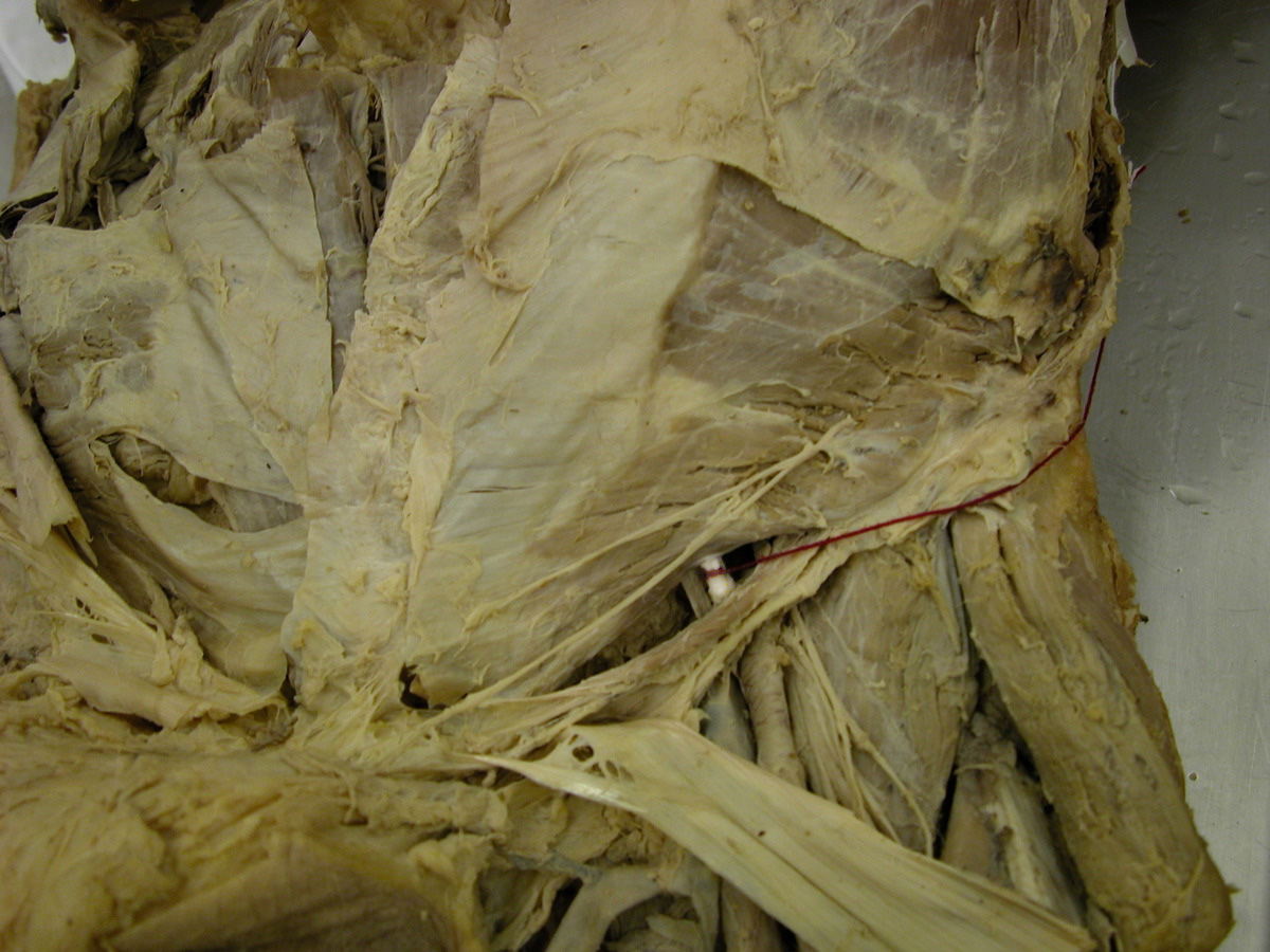 inguinal ligament cadaver