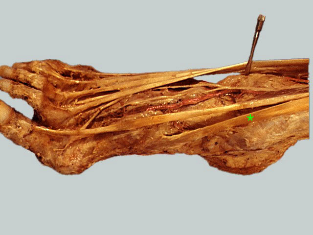 Gross Anatomy Image