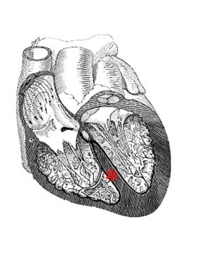 interventricular sulcus and septum